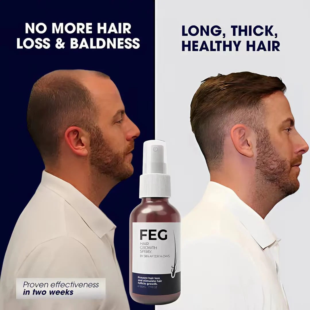 FEG Plus USA Hair Regrowth Spray – Targets Bald Spots, Boosts Thick Hair Growth | 50 ML
