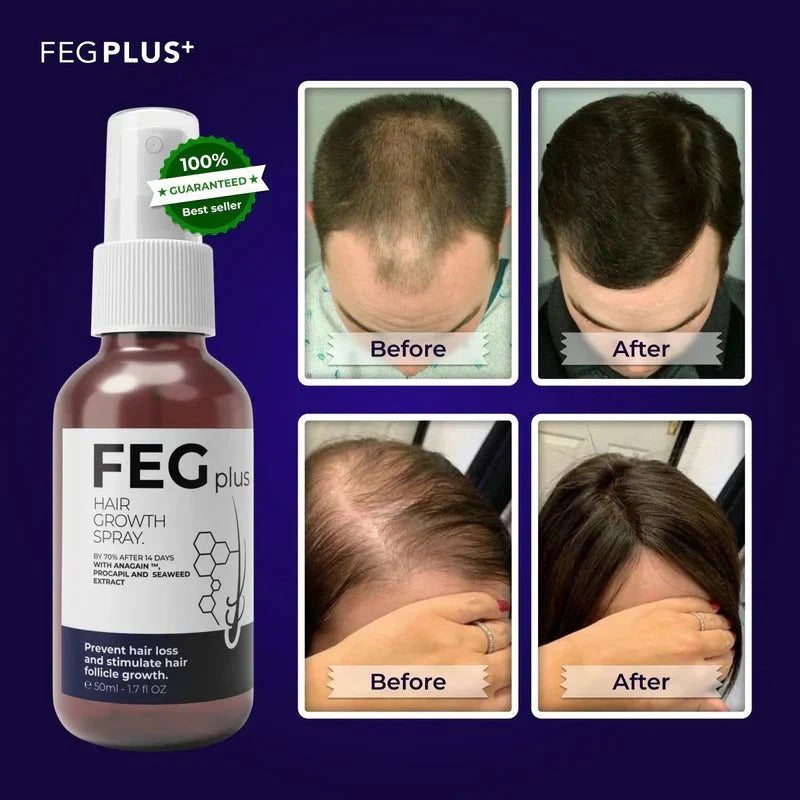 FEG Plus USA Hair Regrowth Spray – Targets Bald Spots, Boosts Thick Hair Growth | 50 ML