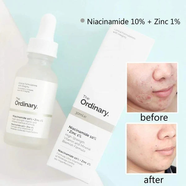 the ordinary niacinamide 10 zinc 1